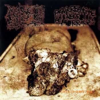 Rancid Flesh & Pankreatite Necro Hemorragica  - Split CD (2010)