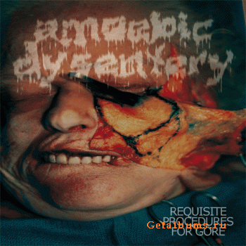 Lymphatic Phlegm / Amoebic Dysentery – Late Pathological Findings / Requisite Procedures For Gore (2011) Lymphatic Phlegm / Amoebic Dysentery – Late Pathological Findings / Requisite Procedures For Gore (2011)