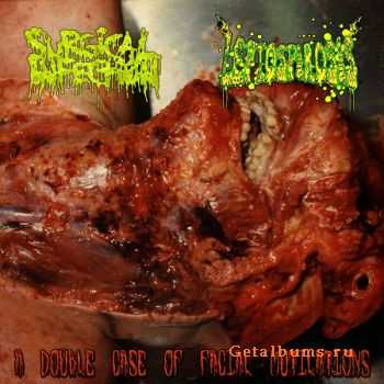 Surgical Infection & Leptospirosis - A Double Case Of Facial Mutilations (Split) (2011)