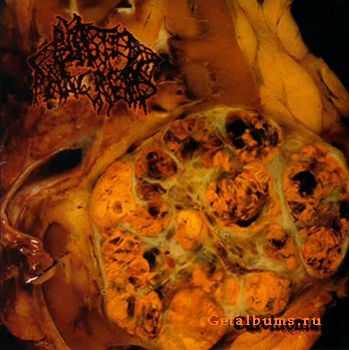 Blasted Pancreas - Carcinoma (2012)