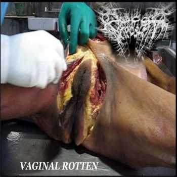 Bucal Defecation - Vaginal Roten (Demo) (2011)