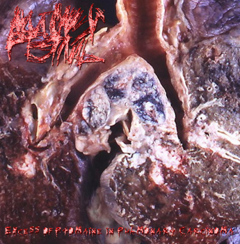 Autopsy Festival - Excess Of Ptomaine In Pulmonary Carcinoma (2012)