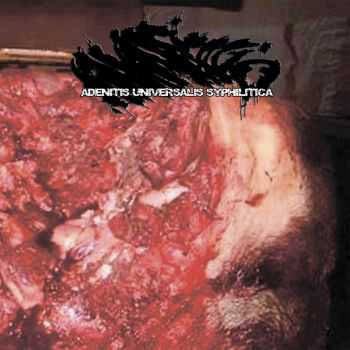 Mumuficatio - Adenitis Universalis Syphilitica (EP) (2013)