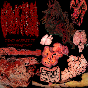 Splancnologia - Dead Corpse In Putrefaction (2013)