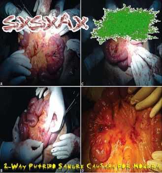 SxSxAx & DxTxS - 2-Way Putrido Sangre Causada Por Monera (2013)