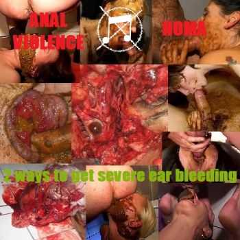 Anal Violence & NOMA - 2 Ways To Get Severe Ear Bleeding (Split) (2013)