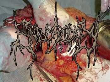 Endoscopy - Demo (2014) Endoscopy - Demo (2014)