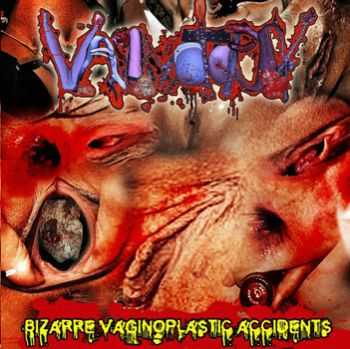 Vaginotopsy - Bizarre Vaginoplastic Accidents (2011) Vaginotopsy - Bizarre Vaginoplastic Accidents (2011)