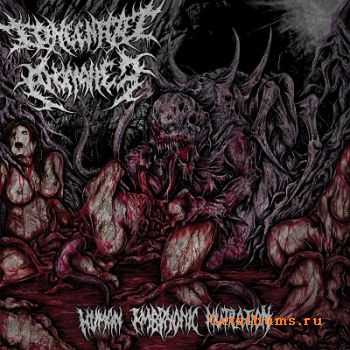 Congenital Anomalies - Human Embryonic Mutilation (2014)