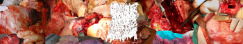 ROYHSWAPS - The Obstruction of the Pancreatic Ducts Causing the Malfunction of the Hepatopancreatic Ampulla (2014) ROYHSWAPS - The Obstruction of the Pancreatic Ducts Causing the Malfunction of the Hepatopancreatic Ampulla (2014)