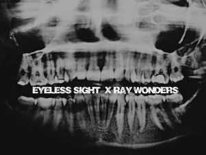 Eyeless Sight - X-Ray Wonders (2015)