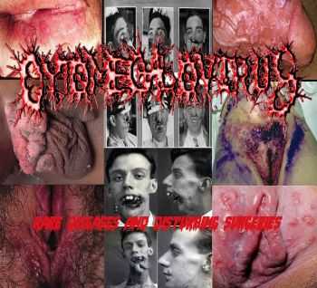 Cytomegalovirus - Rare Diseases and Disturbing Surgeries (Demo) (2015)