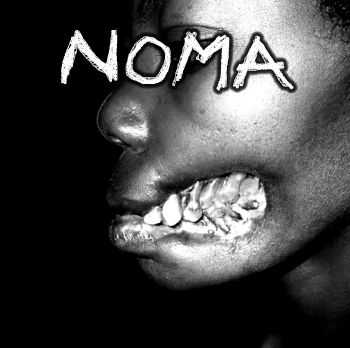 NOMA - DEMO (2016)