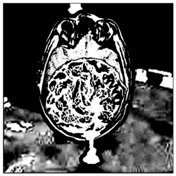 Destruktionsanstalt - Cerebrum Daemonia (EP) (2018)