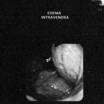 Edema Intravenosa - Set The World On Fire (EP) (2018)