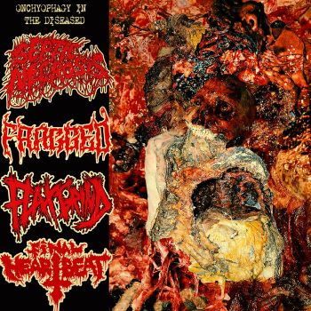 Final Heartbeat / Flax / Septic Necrosis / Fragged - Onchyophagy in the Diseased (2023)
