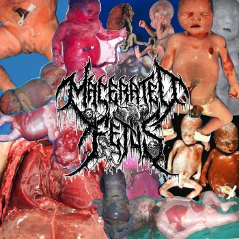 Macerated Fetus - Demo (2024)
