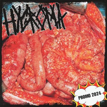 Hygroma - Promo 2024 (2024)