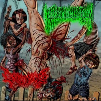 Intercranialectomy / Gruesome End - Children Saw Torture (2024)