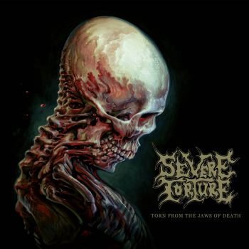 Severe Torture - The Pinnacle of Suffering [Singles] (2024)