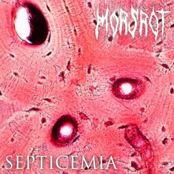 Morsrot - Septicemia (2024)