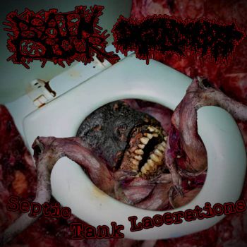 Acid Meat / Brain Decor - Septic Tank Lacerations (2024)