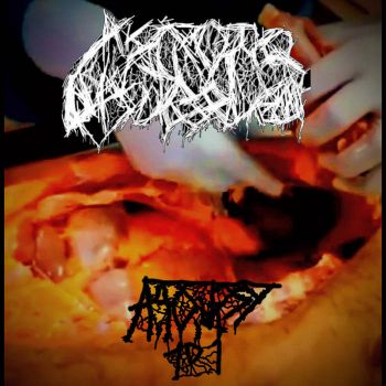 Necrotic Dismemberment - Autopsy 101 (2025)