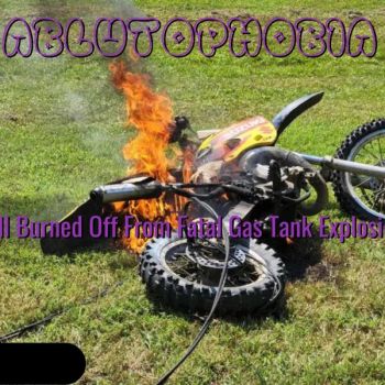 Ablutophobia - Ball Burned Off from Fatal Gas Tank Explosion (2025)