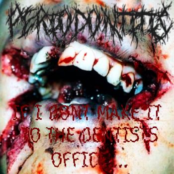 Periodontitis - If I Don't Make It to the Dentists Office... (2025)