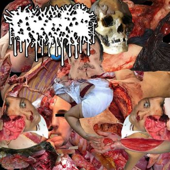 Gastric Fasciitis - Gastric Fasciitis (2025)