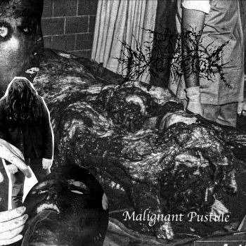 Pus Excretor - Malignant Pustule (2025)