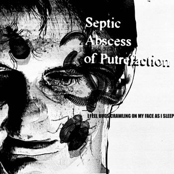 Septic Abscess of Putrefaction - I Feel Bugs Crawling on My Face as I Sleep (2025)