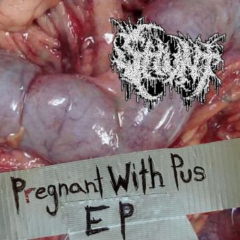 Shunt - Pregnant with Pus (2025)
