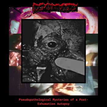 Fetid Putridity - Pseudopathological Mysteries of a Post-Exhumation Autopsy (2025)