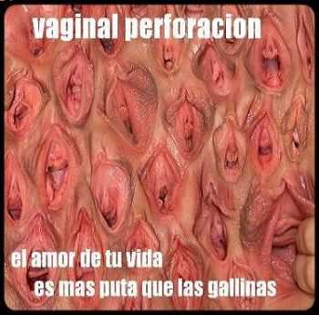 Vaginal Perforacion - El Amor De Tu Vida Es Mas Puta Que Las Gallinas [Demo] (2011)