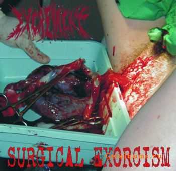 Excrement / Hipermenorrea - Surgical Exorcism / Auriculoventriculostomia Cefalorraquidea Subaracnoidea Basilar Cerebral (2005)