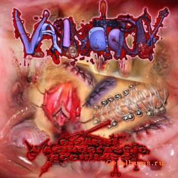 Vaginotopsy - Bizarre Vaginoplastic Accidents (Promo) (2011)