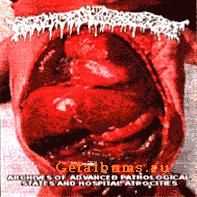 Feculent Goretomb - Archives of Advance Pathological States and Hospital Atrocities [demo] (2000)