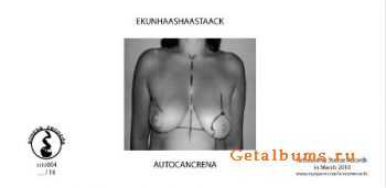 Ekunhaashaastaack / Autocancrena - Untitled (2010)