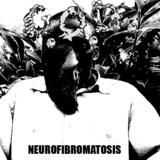 Grotesque Organ Defilement - Neurofibromatosis (Demo) (2007)