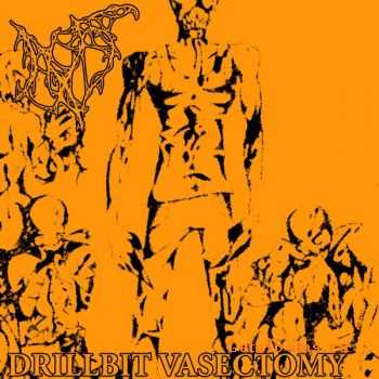 NX5 - Drillbit Vasectomy (EP) (2008)