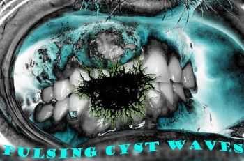 Dentalcyst - Pulsing Cyst Waves [EP] (2012)