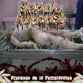 Septic Autopsy - Procesos De La Putrefaccion!!! (2012)