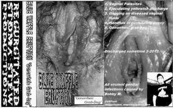 Blue Waffle Eruption - st [demo] (2011)