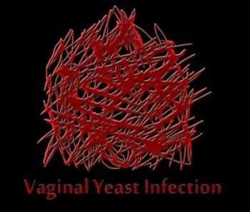 Vaginal Opening - Vaginal Yeast Infection (Demo) (2012)