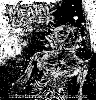 Meatal Ulcer - Intermittent Claudication [demo] (2012)