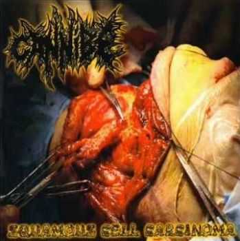 Cannibe - Squamous Cell Carcinoma (EP) (2012)