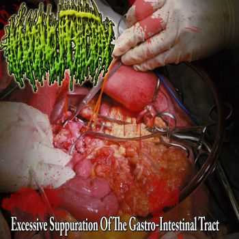 Hydropneumothorax - Excessive Suppuration Of The Gastro-Intestinal Tract (EP) (2013)