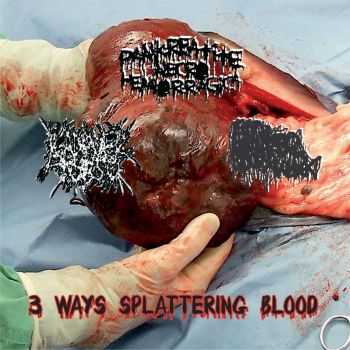 Kadaver Torso & Pankreatite Necro Hemorragica & KxPxLxSxTxTxKx - 3-Ways Splattering Blood (Split) (2011)