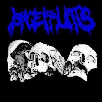 Encefalitis - Demo 1 (2013)